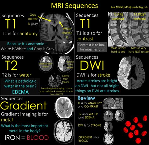 the villages brain mri|Diagnostic Radiology .